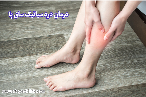 درمان درد سیاتیک ساق پا