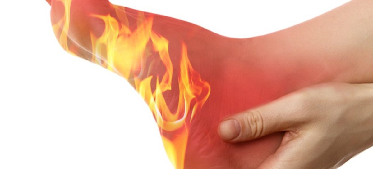 سوزش پا در بیماران دیابتی