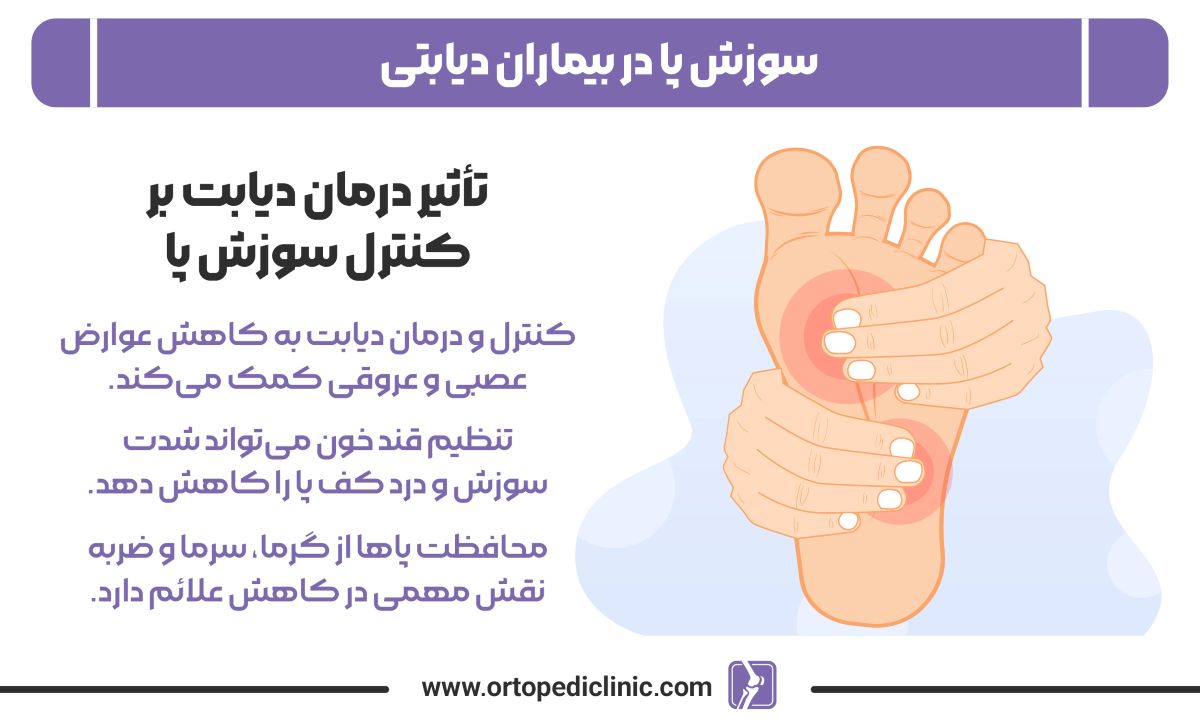 سوزش پا در بیماران دیابتی