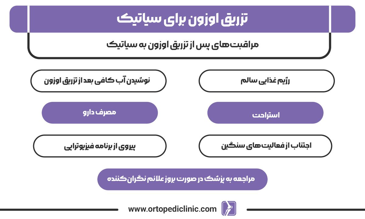 تزریق اوزون برای سیاتیک