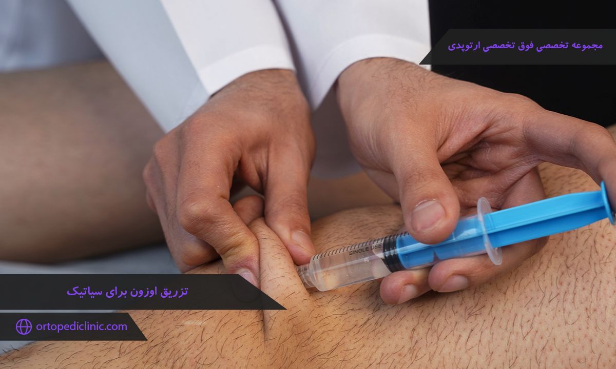 تزریق اوزون برای سیاتیک